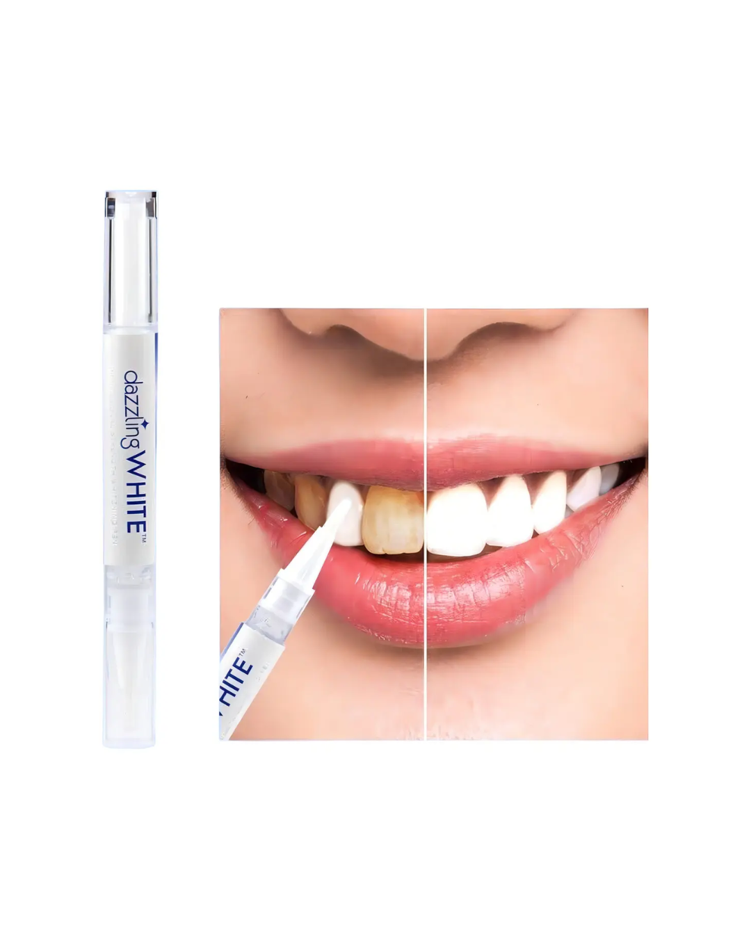 L&aacute;piz blanqueador dental